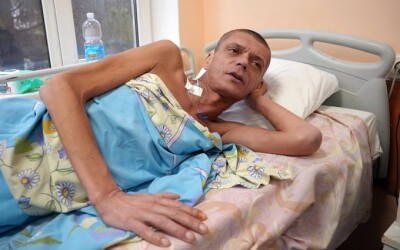 У Харкові прооперували військового, який 36 діб провів на позиціях з турнікетом на нозі