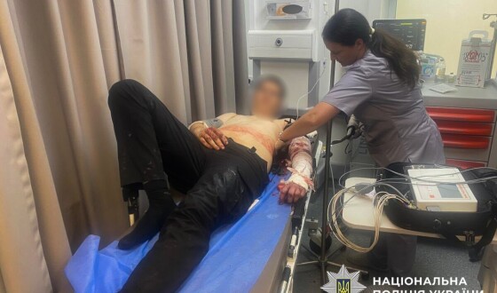 Озброєний напад на поліцейських у Запоріжжі: троє правоохоронців поранені, нападника вбито